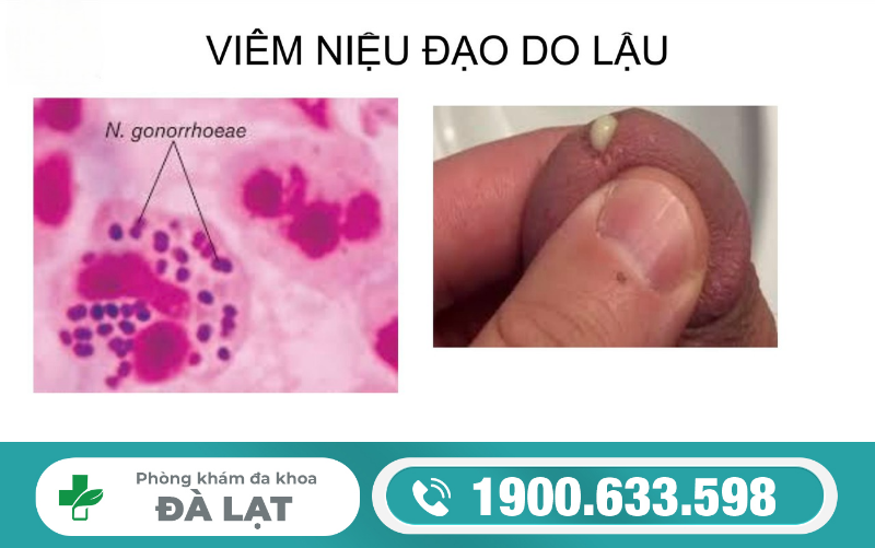 Hình ảnh minh họa